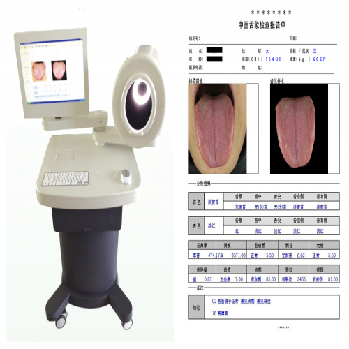 中醫(yī)舌診圖像分析系統(tǒng)（臺車式）